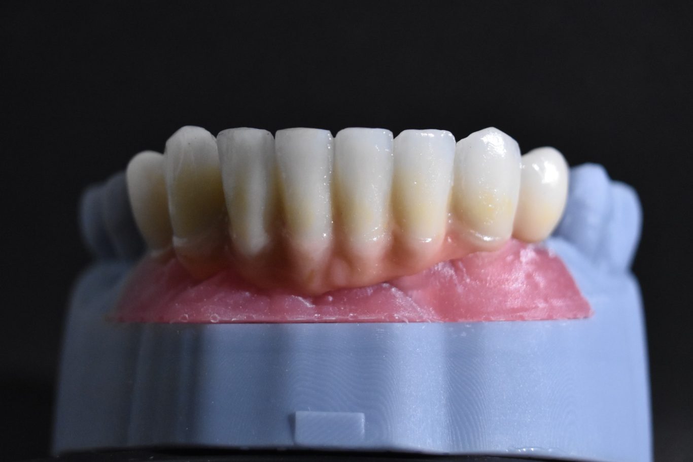 Zirconio-Cerámica 34-44