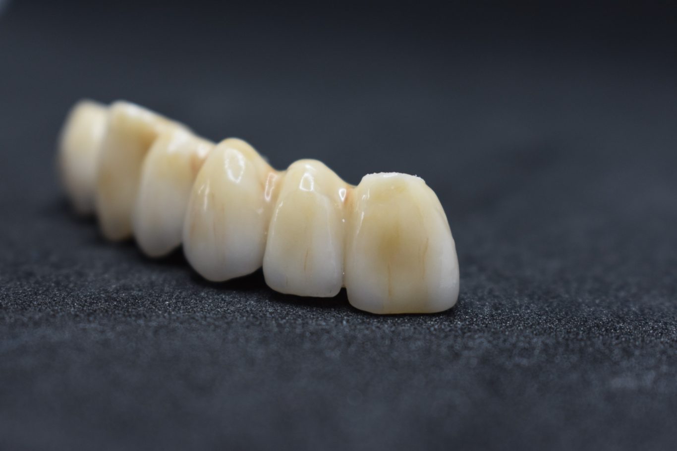 Zirconio-Cerámica 11-16