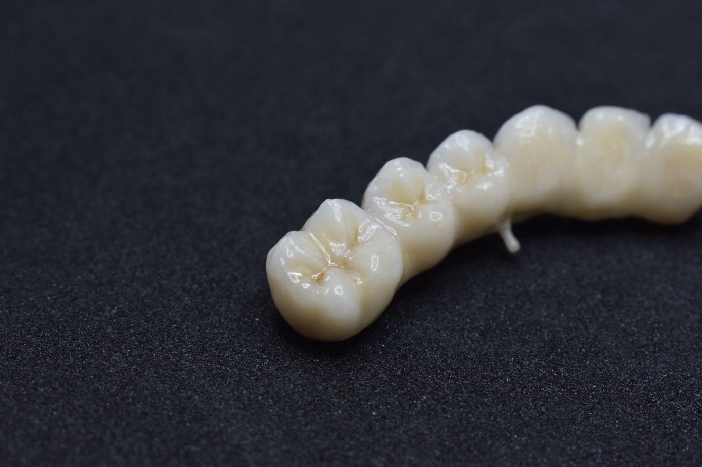 Zirconio-Cerámica 11-16