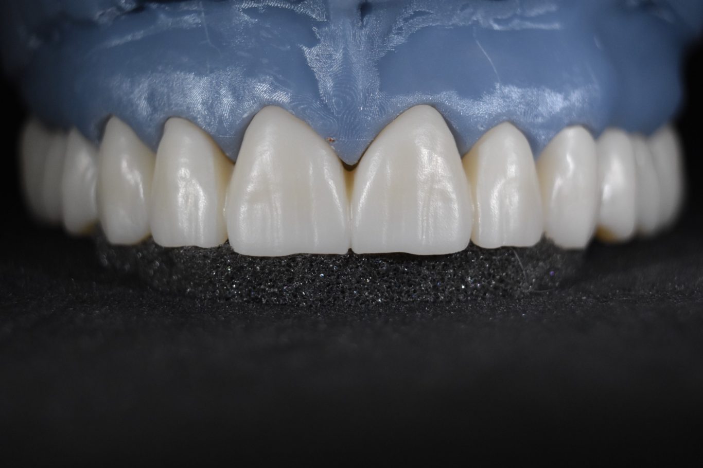 Zirconio monolítico 16-26 sin maquillaje y sin glaseado