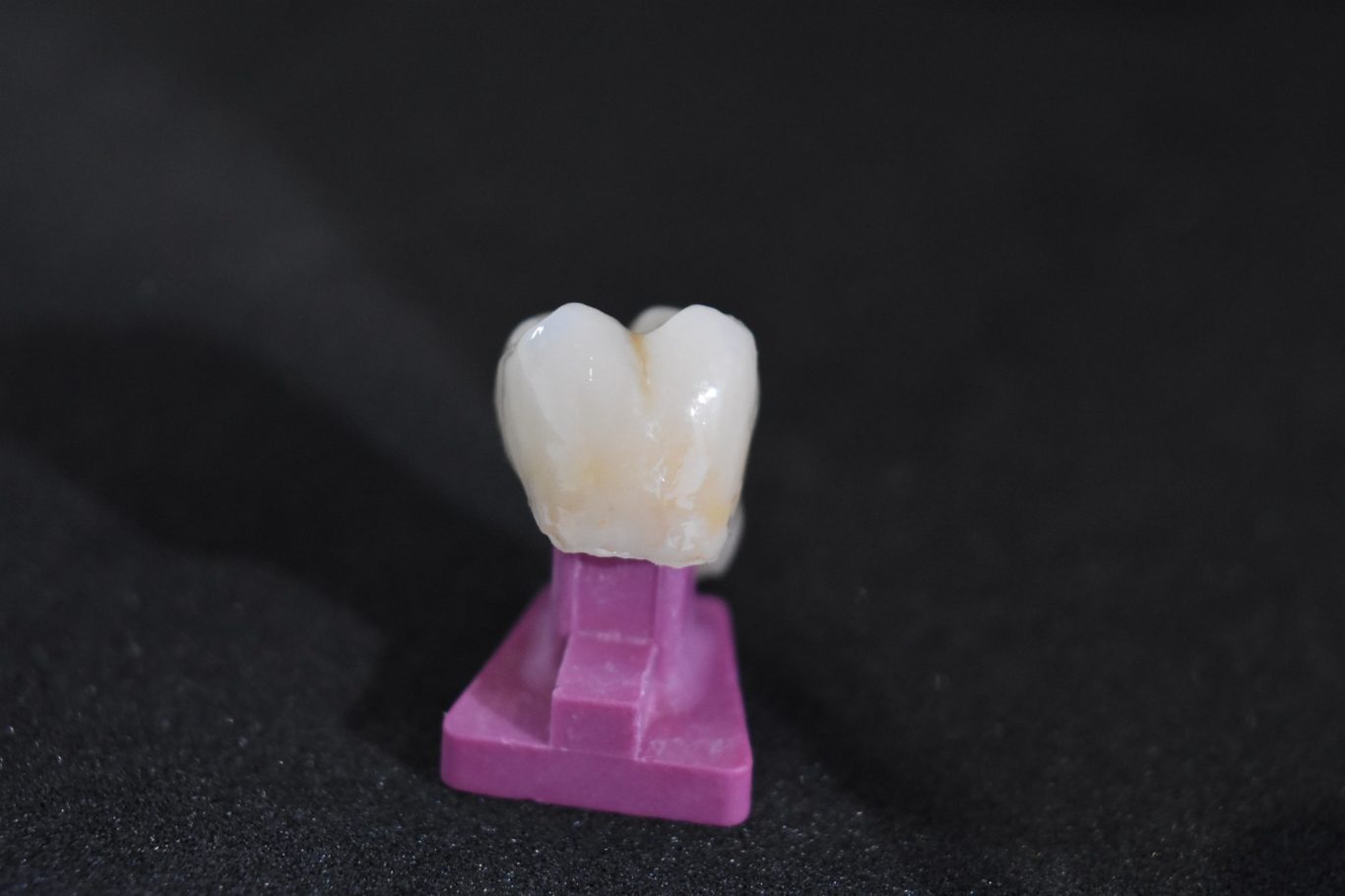 Zirconio-Cerámica (16)