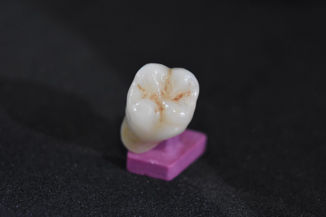 Zirconio-Cerámica (16)