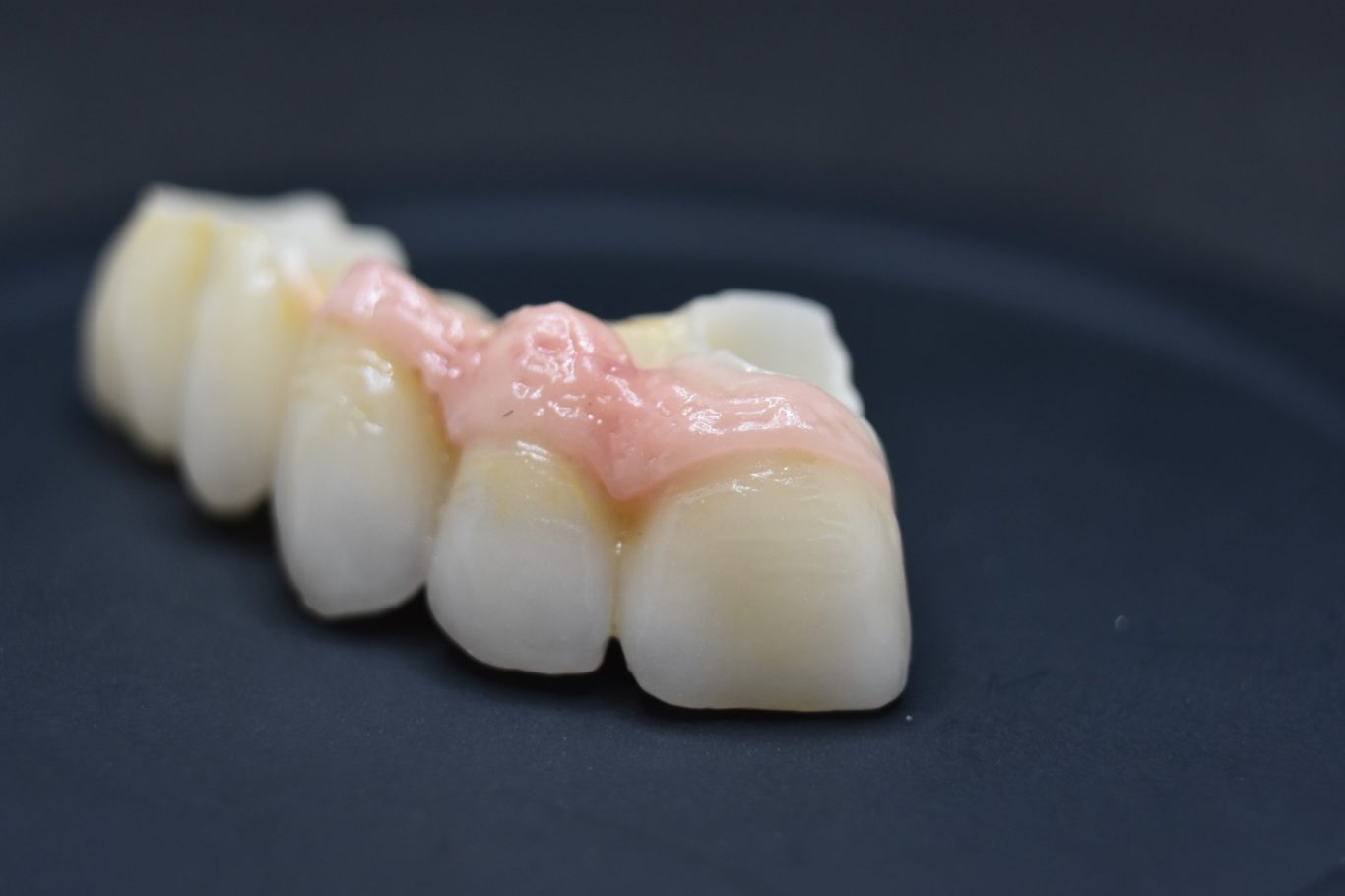 Zirconio-Cerámica 11-16